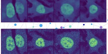With AI, researchers predict the placement of just about any protein inside a human cell | MIT Information