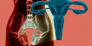 A girl’s uterus has been stored alive outdoors the physique for the primary time